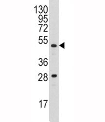 Urokinase Antibody