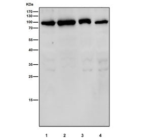 GFPT1 Antibody / GFAT