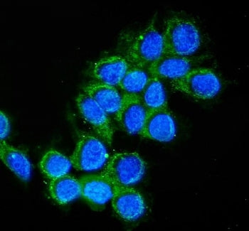 Immunofluorescent staining of FFPE human MCF7 cells with Cathepsin D antibody (green) and DAPI nucle
