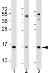 Phospholipase A2 Antibody / PLA2G2A / sPLA2