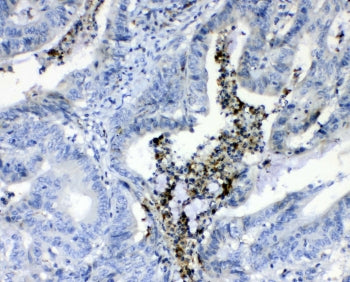 Prothrombin Antibody