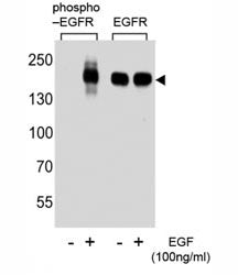 Phospho-EGFR Antibody (pS1070)