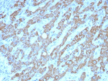 CPS1 Antibody / Carbamoyl phosphate synthetase 1