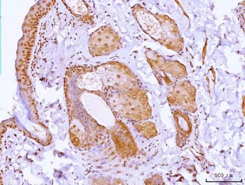 HOXC12 Antibody