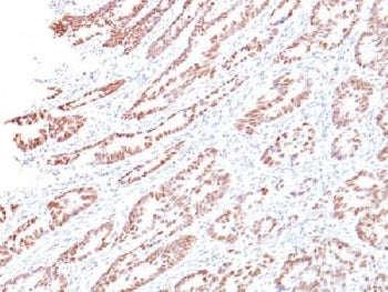 IHC testing of human colon with Rb antibody (clone 1F8). Required HIER: boil tissue sections in 10mM