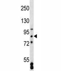 SATB2 Antibody