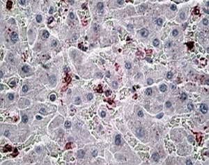 CCL20 Antibody