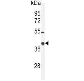 TXNL2 Antibody / GLRX3