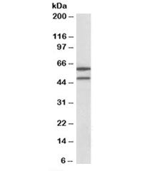 Western blot testing of HeLa lysate with IL13RA2 antibody at 1ug/ml. Predicted molecular weight: ~44