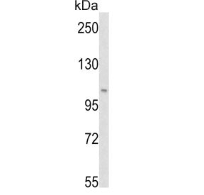 PI3KC3 Antibody
