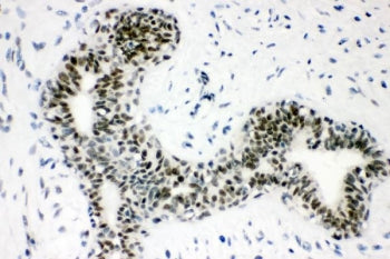 SUMO1 Antibody