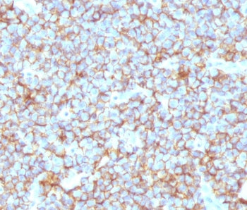 CD99 Antibody