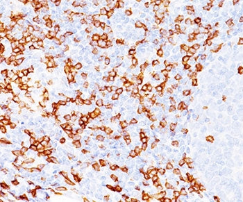 IHC testing of FFPE human tonsil (20X) stained with CD8a antibody (C8/468). Note cell surface staini