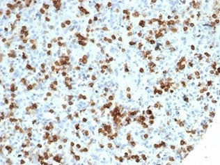 IHC staining of FFPE human spleen tissue with recombinant CD59 antibody (clone MACIF/7021R). HIER: b
