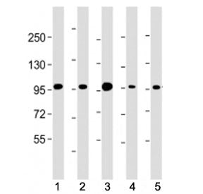 Beta Catenin Antibody (C-Terminal Region)