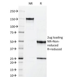 SDS-PAGE Analysis of Purified, BSA-Free ICAM-3 Antibody (clone 101-1D2). Confirmation of Integrity a