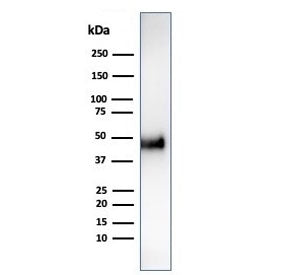 Cyclin E1 Antibody / CCNE1