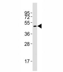 Western blot testing of Smad3 antibody at 1:2000 dilution + rat brain lysate; Observed molecular wei