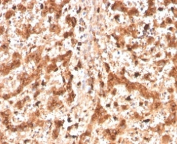 IHC staining of FFPE human liver tissue with CTSD antibody (clone CTSD/4497). HIER: boil tissue sect