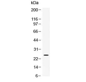 Vegfa Antibody / Vascular endothelial growth factor a