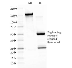SDS-PAGE analysis of purified, BSA-free EBV antibody (clone CS3) as confirmation of integrity and pu