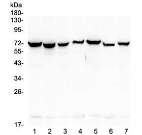 HSP70 Antibody / HSPA1A / HSPA1B