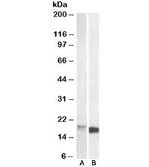 Western blot testing of mouse kidney lysate [A] and of mouse spleen lysate [B] with Pbr antibody at 