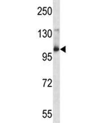 Aak1 antibody western blot analysis in mouse bladder tissue lysate. Predicted molecular weight: ~104