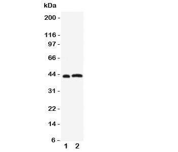 Western blot testing of Leupaxin antibody and Lane 1: rat thymus; 2: human Jurkat cell lysate. Expec