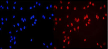 MCM3 Antibody