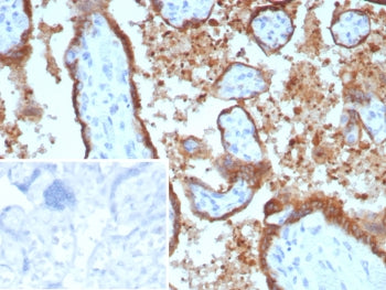 IHC staining of FFPE human placental tissue with EBI3 antibody (clone EBI3/8902). Inset: PBS used in