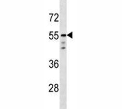 AKT1 Antibody