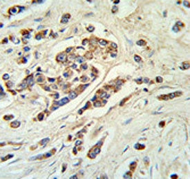 MRP8 Antibody / ABCC11