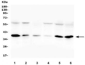 ORAI1 Antibody / CRACM1
