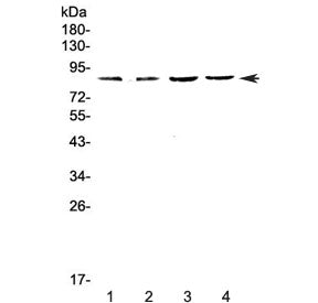 EOMES Antibody / Eomesodermin / TBR2