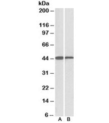 ACAT1 Antibody