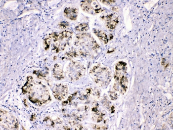 Fibrinogen gamma chain Antibody (FGG)