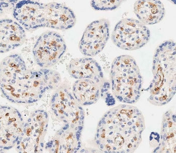 EHD2 Antibody