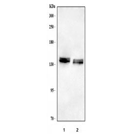 Western blot testing of 1) rat brain and 2) mouse brain tissue lysate with NCAN antibody. Predicted 