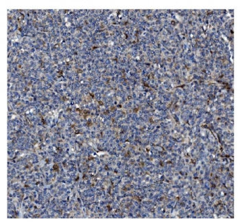 IHC staining of FFPE human lymph node tissue with GSDMD antibody. HIER: boil tissue sections in pH8 