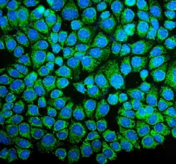 NDUFB10 Antibody