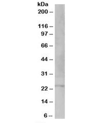 VPS28 Antibody