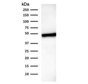 Western blot testing of human stomach lysate with CK18 antibody (clone B23.1). Expected molecular we