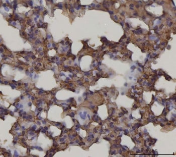 IHC staining of FFPE mouse lung tissue with AGER antibody. HIER: boil tissue sections in pH8 EDTA fo