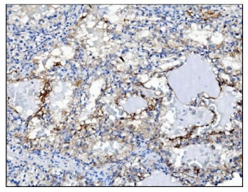 PGP9.5 / UchL1 Antibody