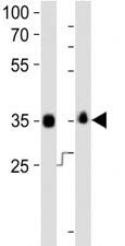 Western blot analysis of lysate from human NCCIT, mouse F9 cell line (left to right) using anti-SOX-