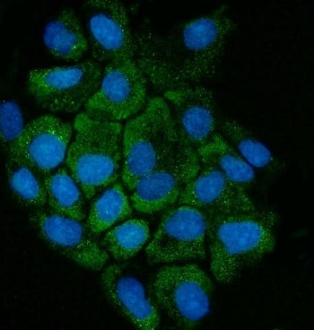Immunofluorescent staining of FFPE human A431 cells with Cystathionase antibody (green) and DAPI nuclear stain (blue). HIER: steam section in pH6 citrate buffer for 20 min.