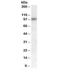 Western blot testing of human pancreas lysate with TAS1R2 antibody at 0.3ug/ml. Predicted molecular 