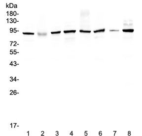 UBA2 Antibody / SUMO-activating enzyme subunit 2 / SAE2