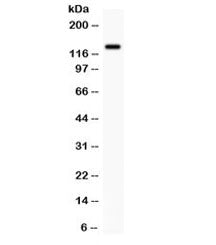 Western blot testing of human SW620 cell lysate with CDCP1 antibody. Expected molecular weight: 93 k